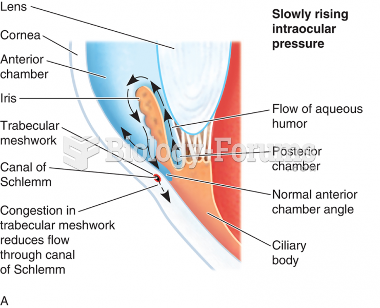 The Pathophysiology of Glaucoma (A) Slowing Rising Intraocular Pressure (I O P)