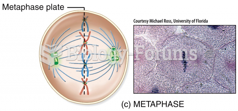 Mitotic Phase: Metaphase