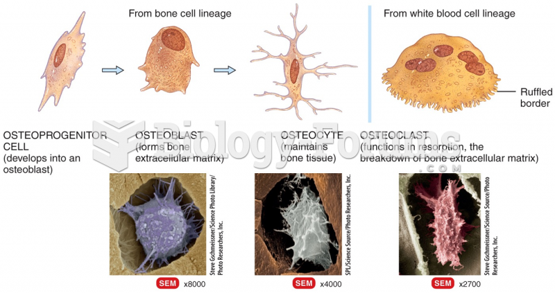 Histology of Bone