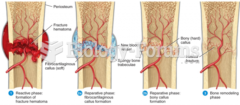 Fracture and Repair of Bone