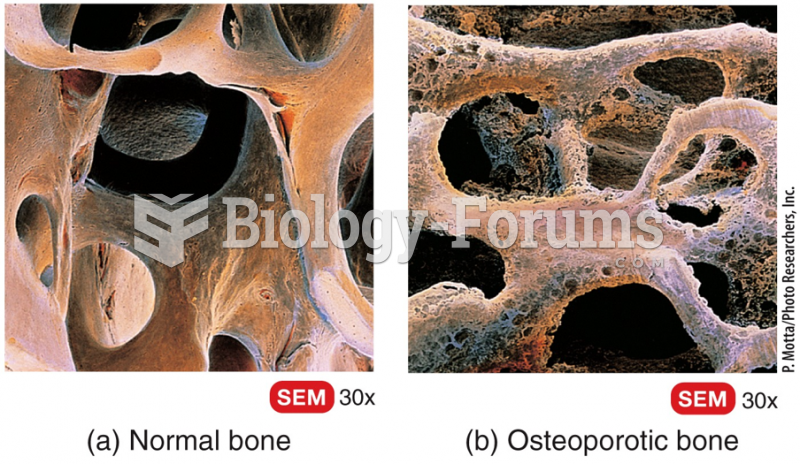 Aging and Bone Tissue