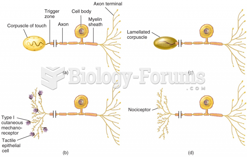 Examples of Sensory Receptors