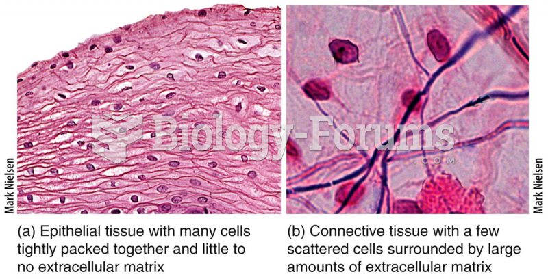 Epithelial vs. Connective Tissue