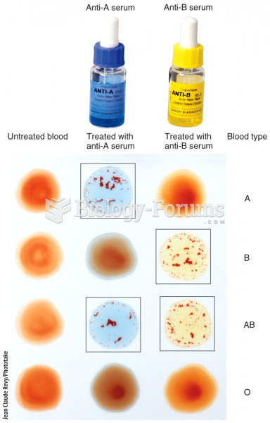 Blood Groups and Blood Types