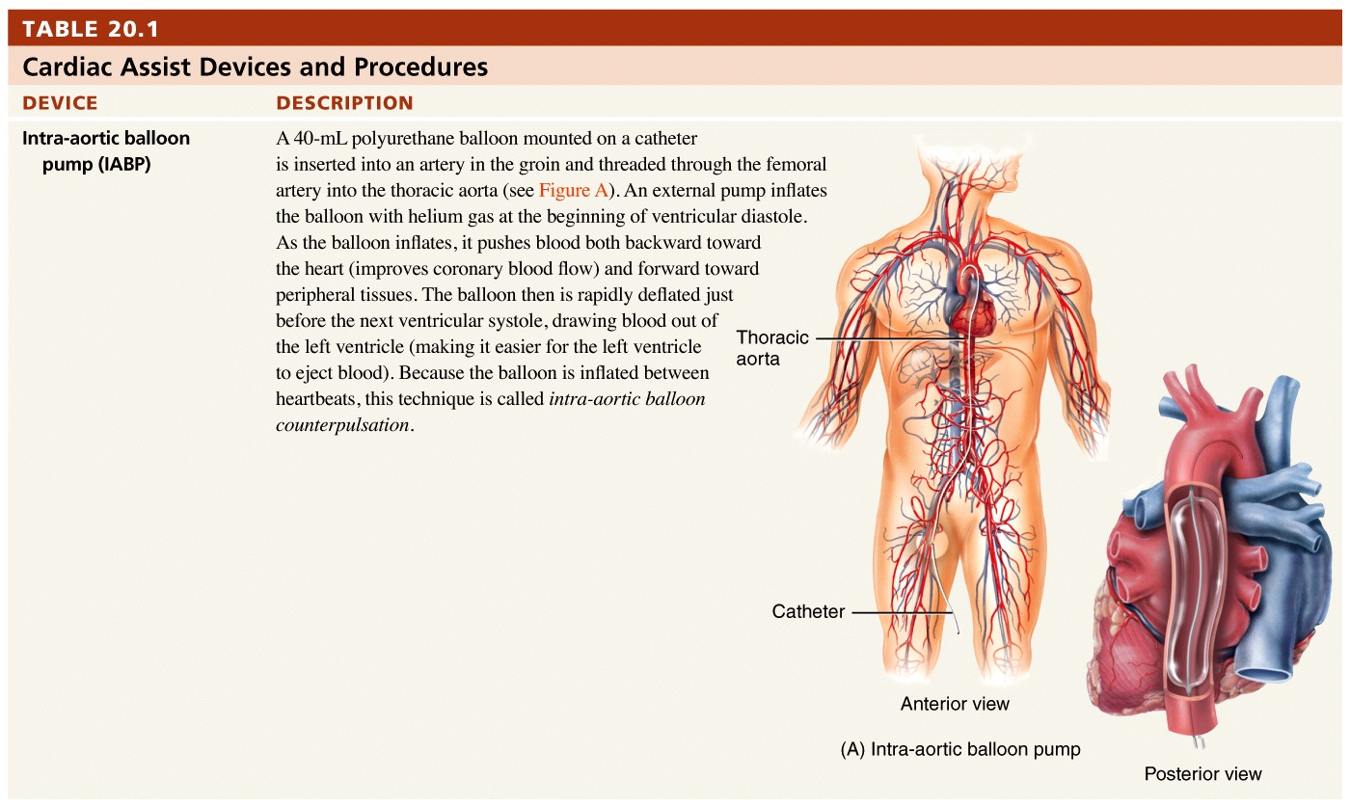 Help for Failing Hearts