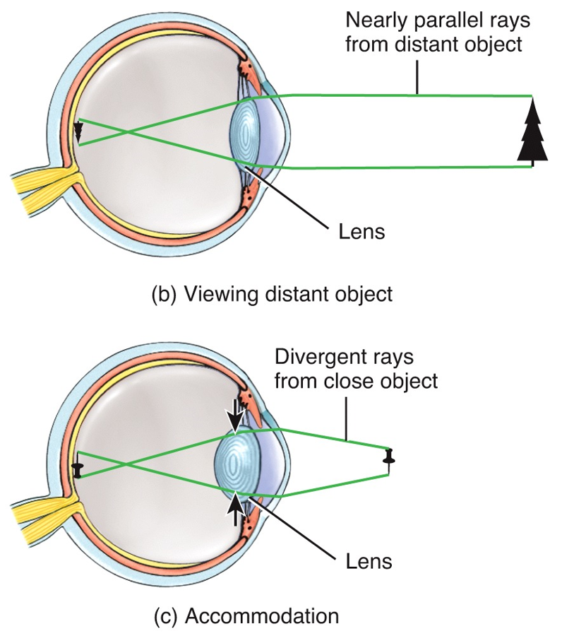 Lens accommodate