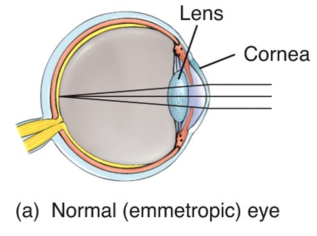 Normal (emmetropic) eye