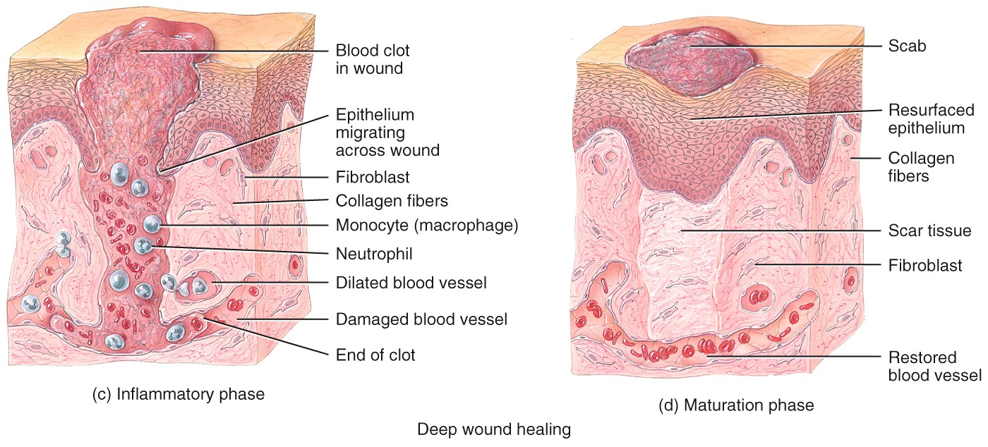 Wound Healing