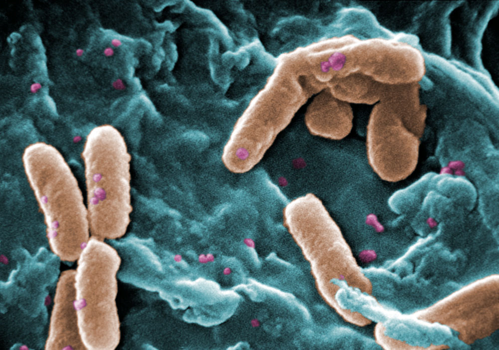 Pseudomonas aeruginosa bacteria showing rod and spore (SEM)