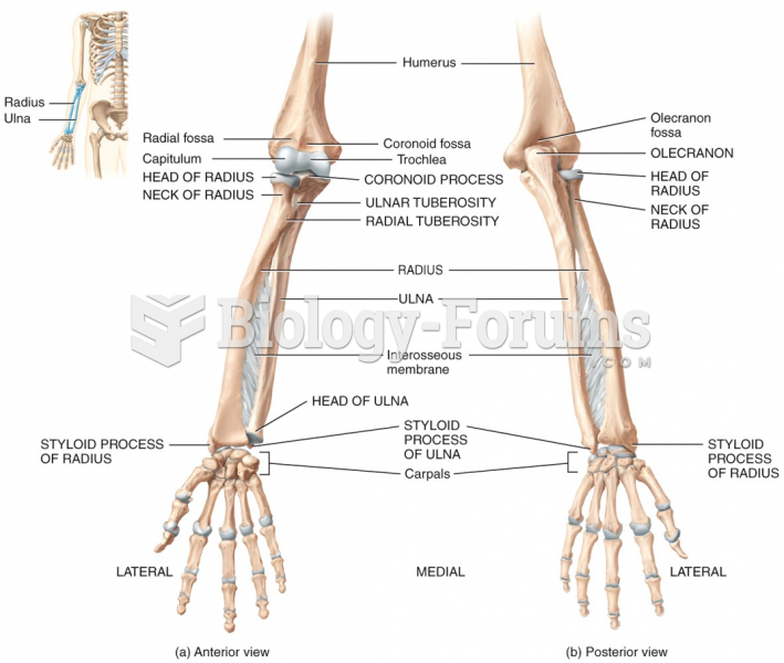 Anterior & Posterior View of Upper Limb (Extremity)