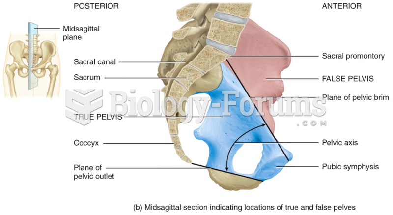 Midsagittal section indicating locations of true and false pelves