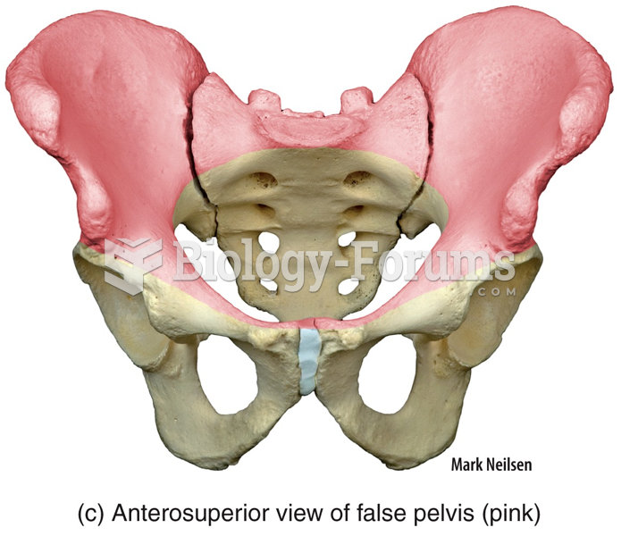 Anterosuperior view of false pelvis (pink)