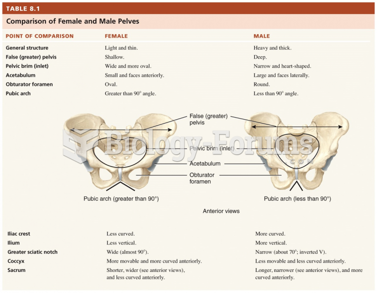 Comparison of Female and Male Pelves