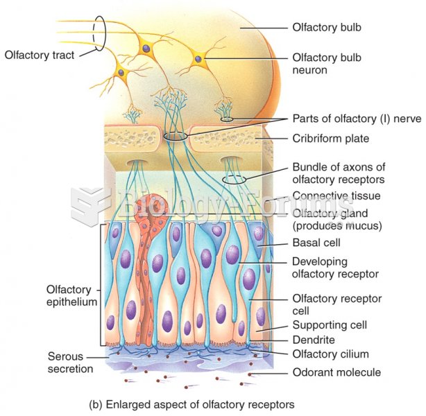 Enlarged aspect of olfactory receptors