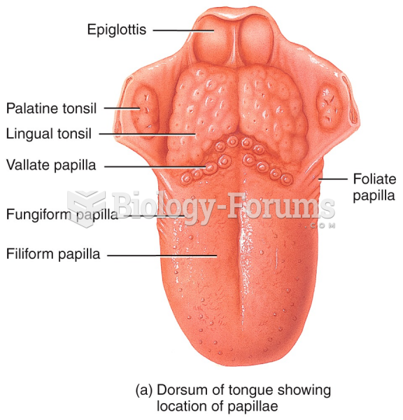 Dorsum of tongue showing location of papillae