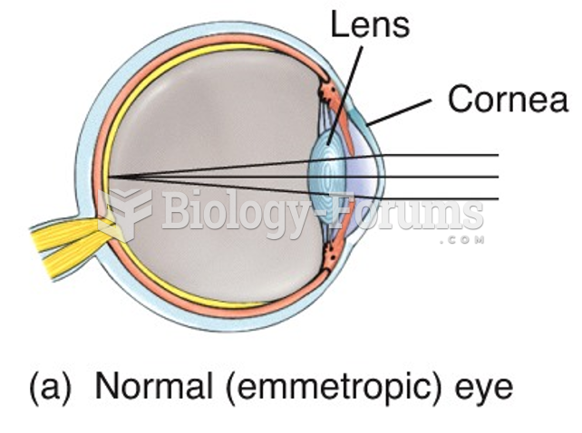 Normal (emmetropic) eye