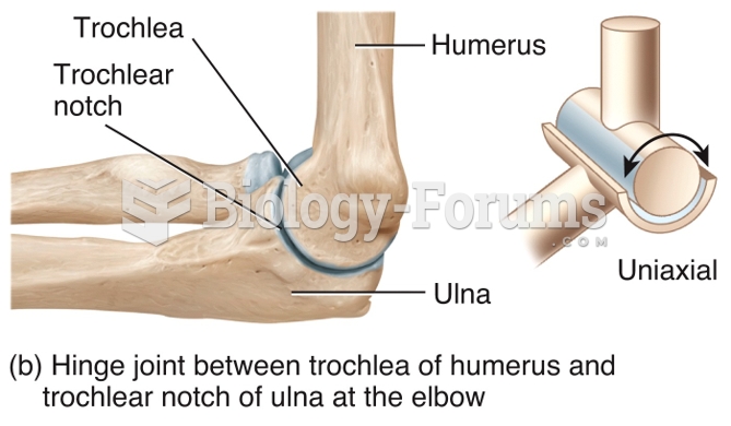 Types of Movement at Synovial Joints