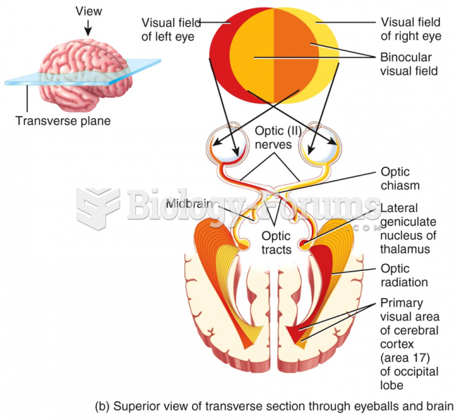 Superior view of transverse section through eyeballs and brain