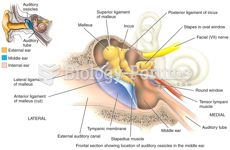 Frontal section showing location of auditory ossicles in the middle ear
