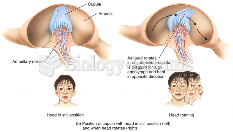 Position of cupula with head in still position (left) and when head rotates (right) 