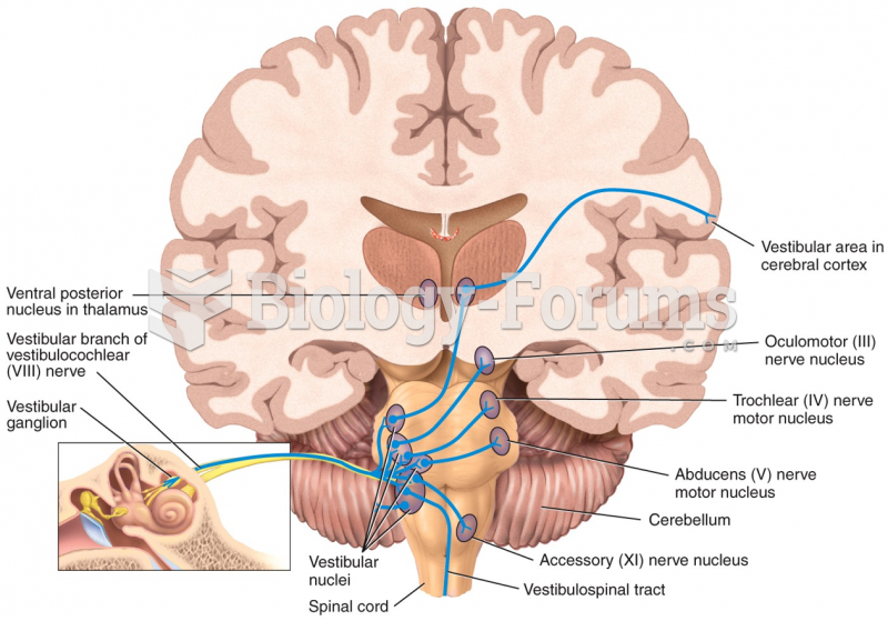 Brain nerve and hearing 