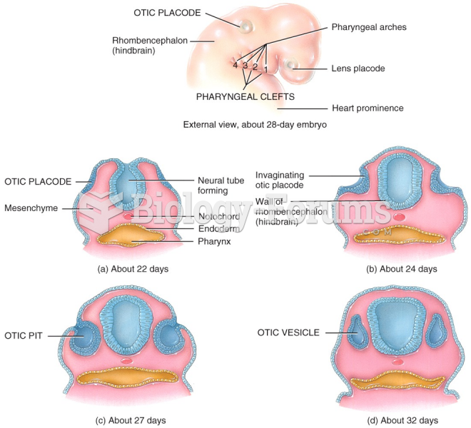 Development of the Eyes and Ears: External View - 28 days Embryo 