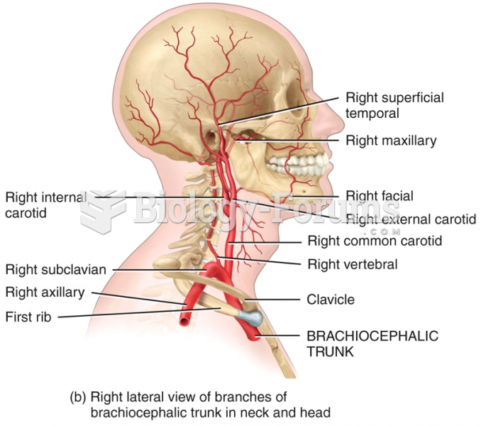 Right lateral view of branches of brachiocephalic trunk in neck and head