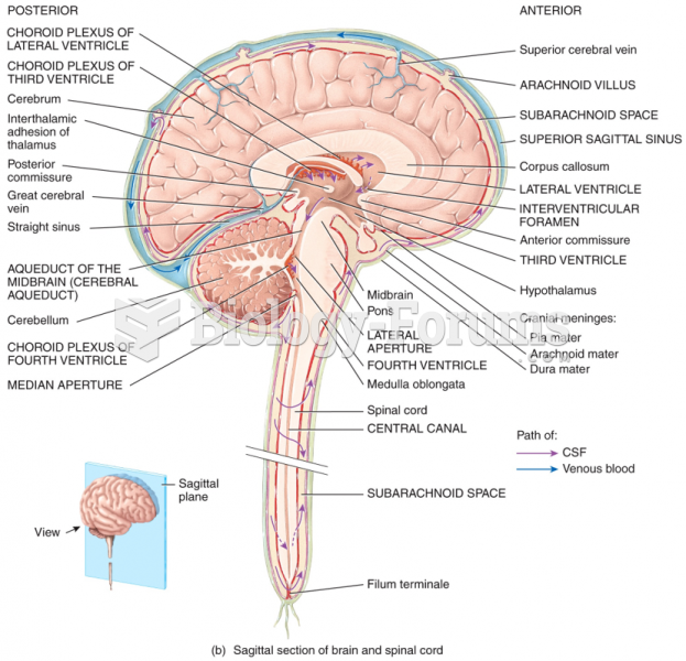 CSF Flow - Sagittal section of brain and spinal cord