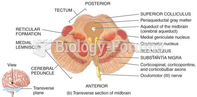 Transverse section of midbrain