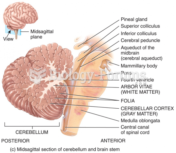 Midsagittal section of cerebellum and brain stem