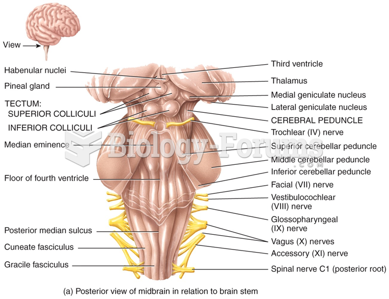 Posterior view of midbrain in relation to brain stem