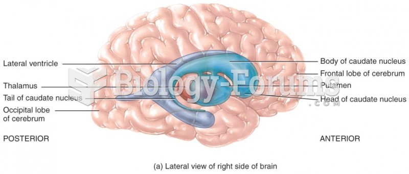 Lateral view of right side of brain