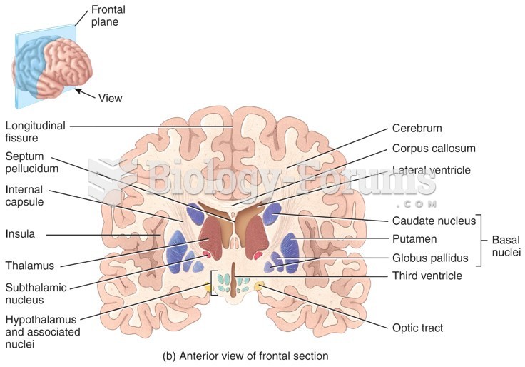 Anterior view of brain frontal section