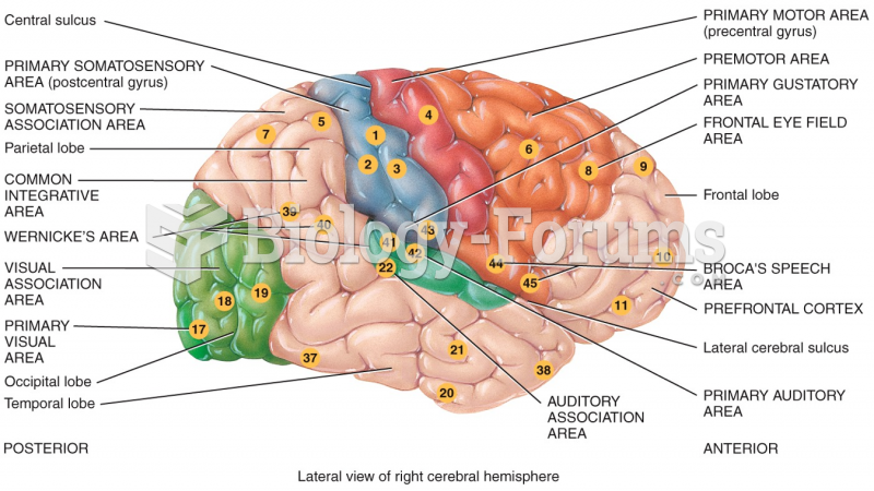 Lateral view of right cerebral hemisphere