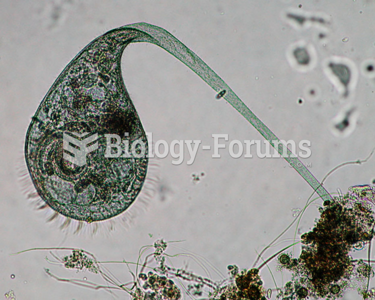 This ciliated protozoan is a Stentor. Stentor are common in freshwater lakes and rivers