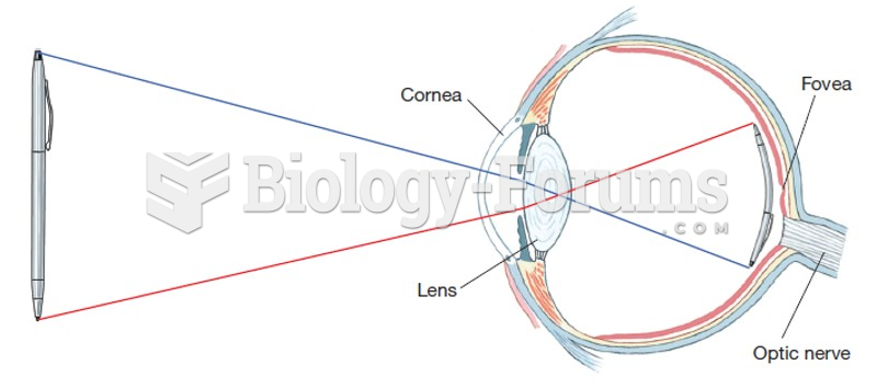 The Retinal Image