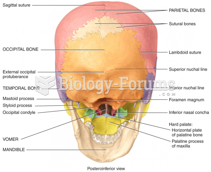 Posteroinferior view of skull