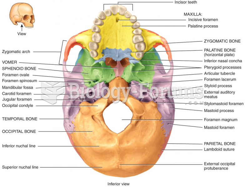 Inferior view of skull
