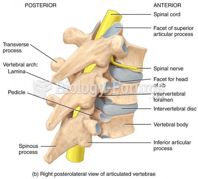 Right posterolateral view of articulated vertebrae