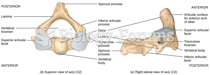 Superior view of axis and right lateral view of axis