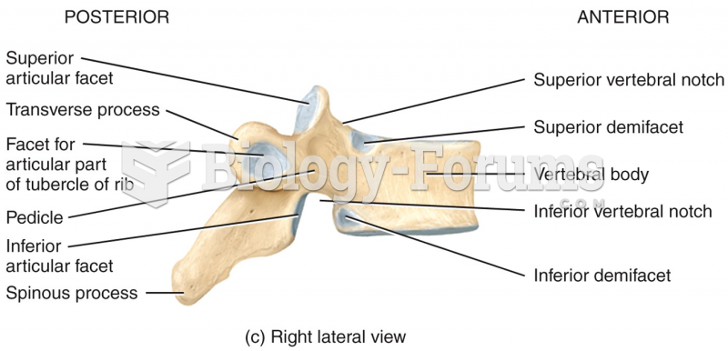 Right Lateral View of Vertebral Column