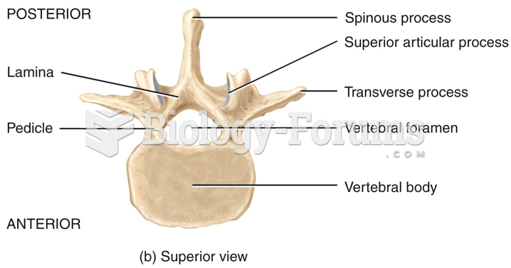 Superior view of lumbar vertebrae