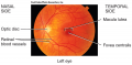 optic disc (blind spot)