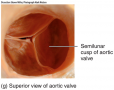 Heart Valves and Circulation of Blood