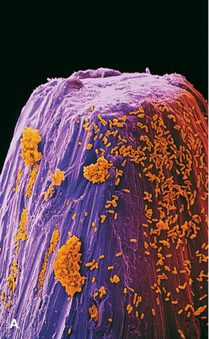 A wide variety of pathogens may live on or in the human body