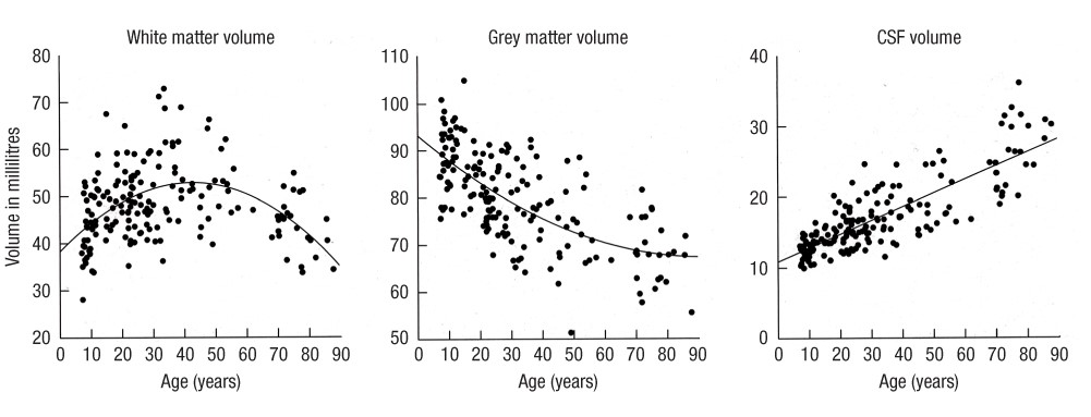 Changes that take place in the brain across the lifespan