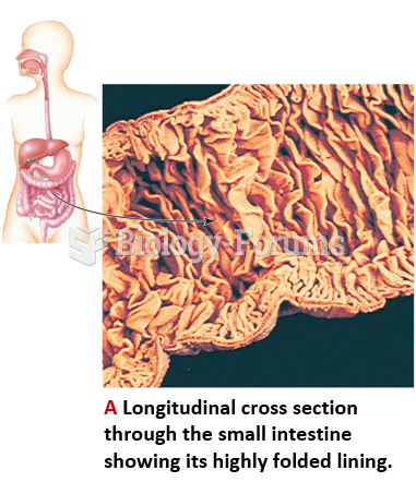 The Small Intestine: A Huge Surface for Digestion & Absorption