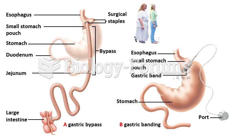 Metabolic syndromes: Dealing with Weight Extremes