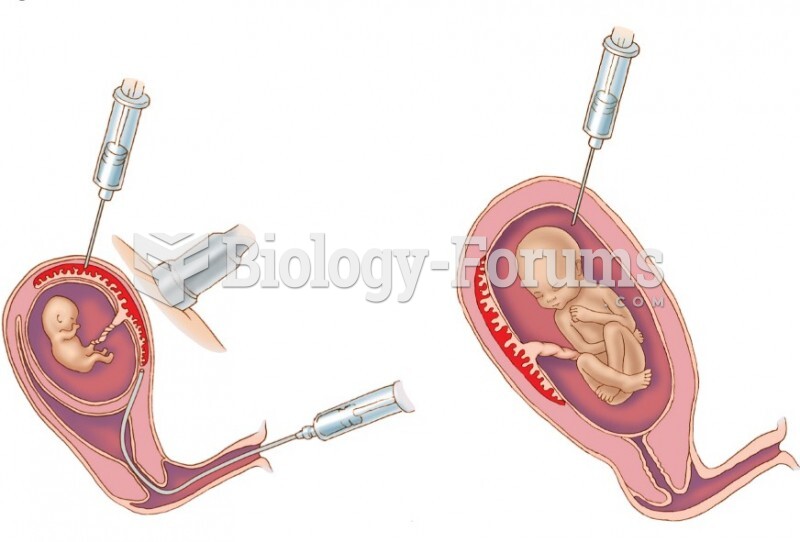 Chorionic villus sampling (left) and amniocentesis (right)