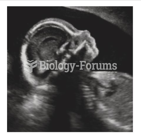 This image shows a normal third-trimester fetal brain